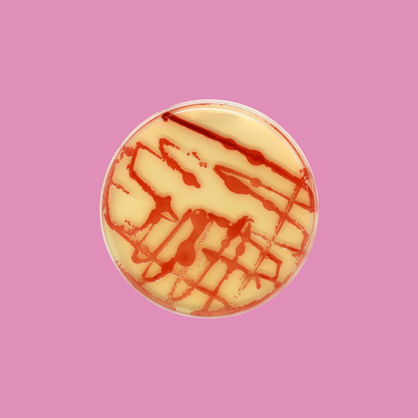 An overhead shot of a Petri dish containing light yellow bacteria with bright red splashes.