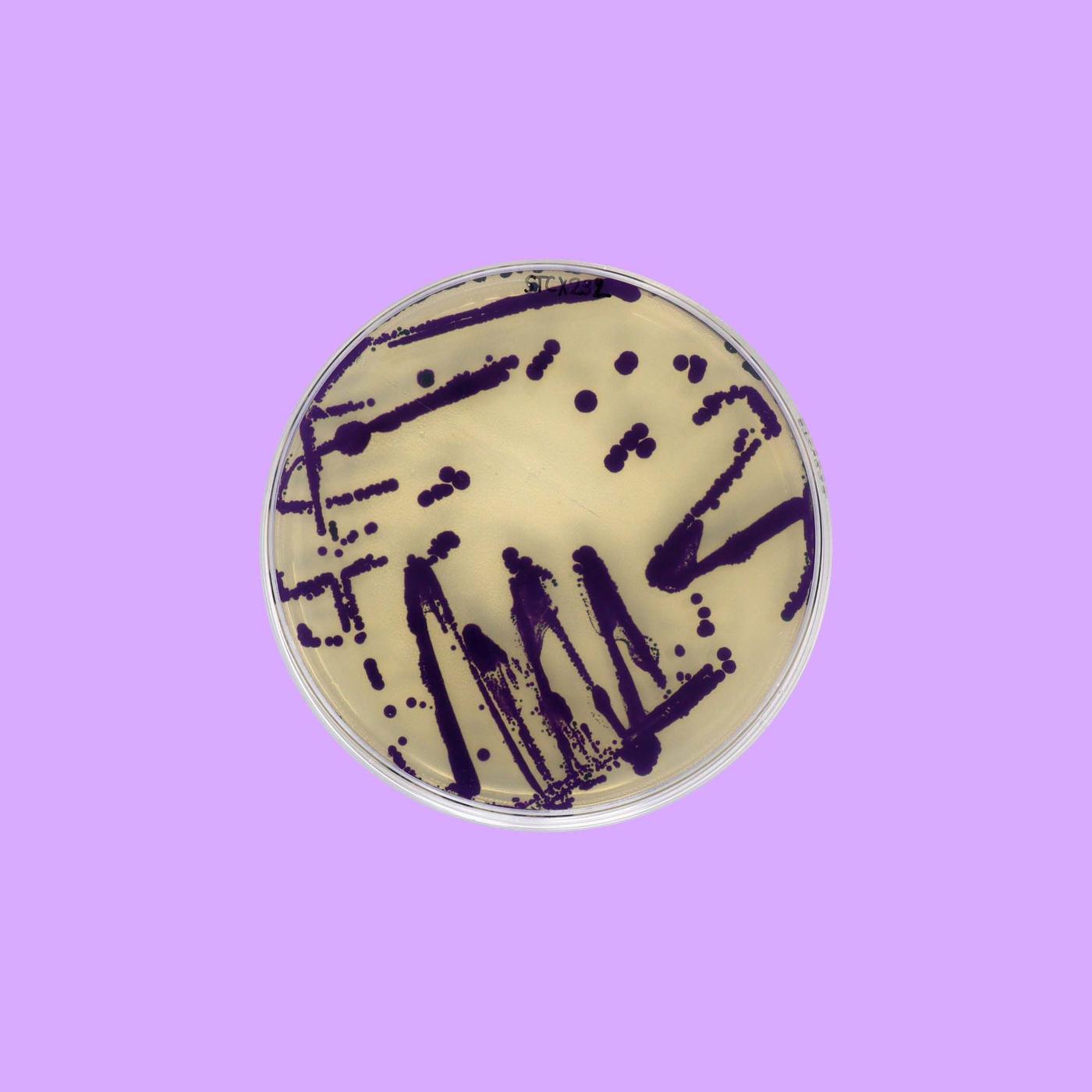 An overhead shot of a Petri dish containing light yellow bacteria with dark purple splashes.