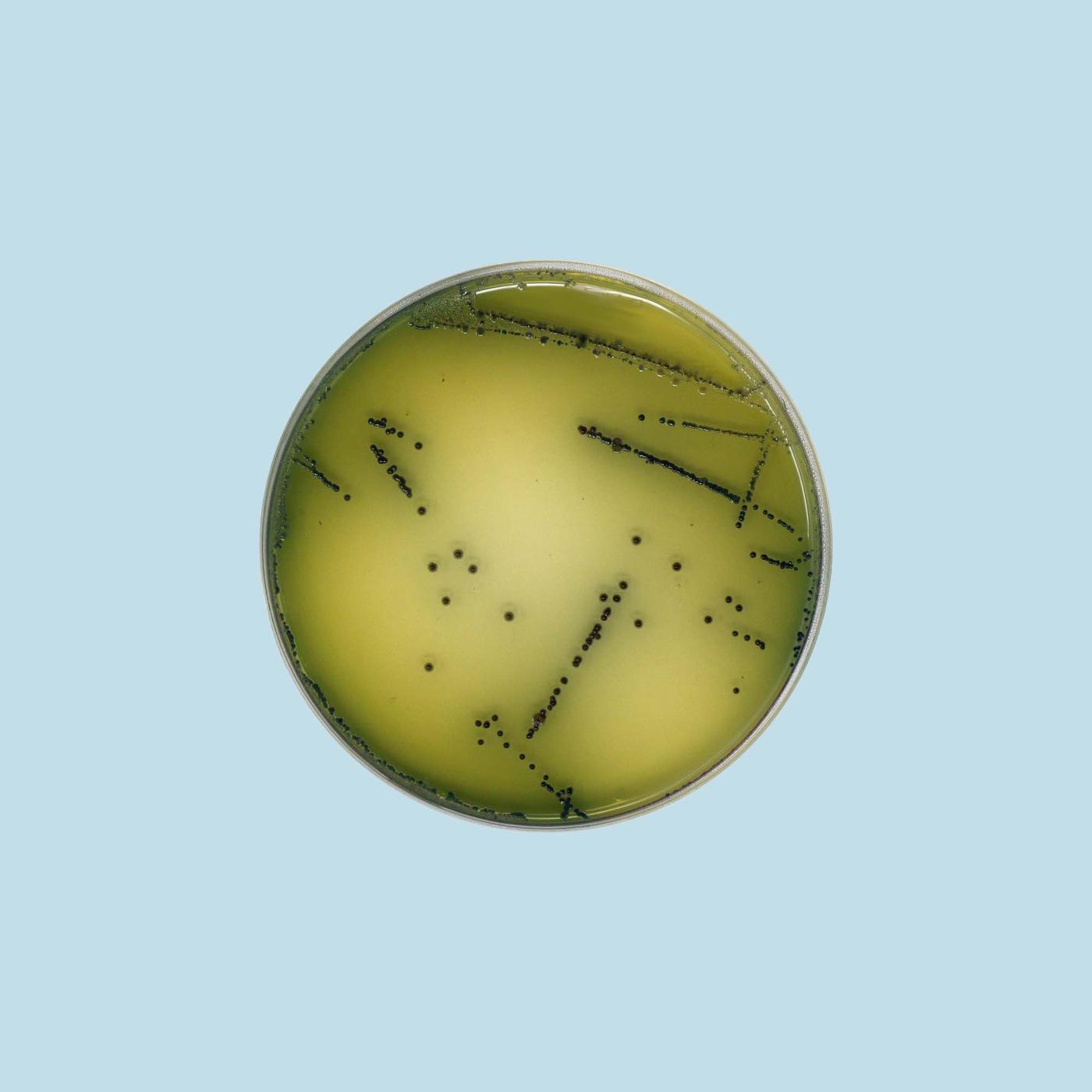 An overhead shot of a Petri dish containing green bacteria with black speckles.