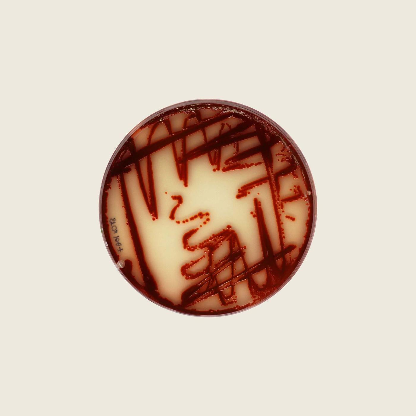 An overhead shot of a Petri dish containing cream-coloured bacteria with deep red splashes.