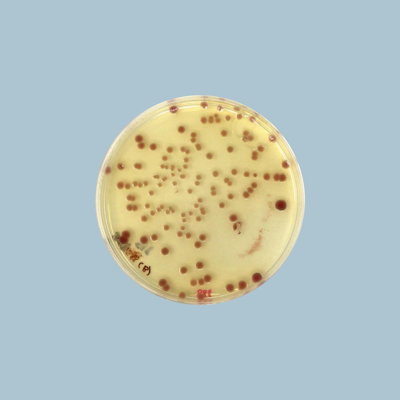 An overhead shot of a Petri dish containing light yellow bacteria with brown dots.