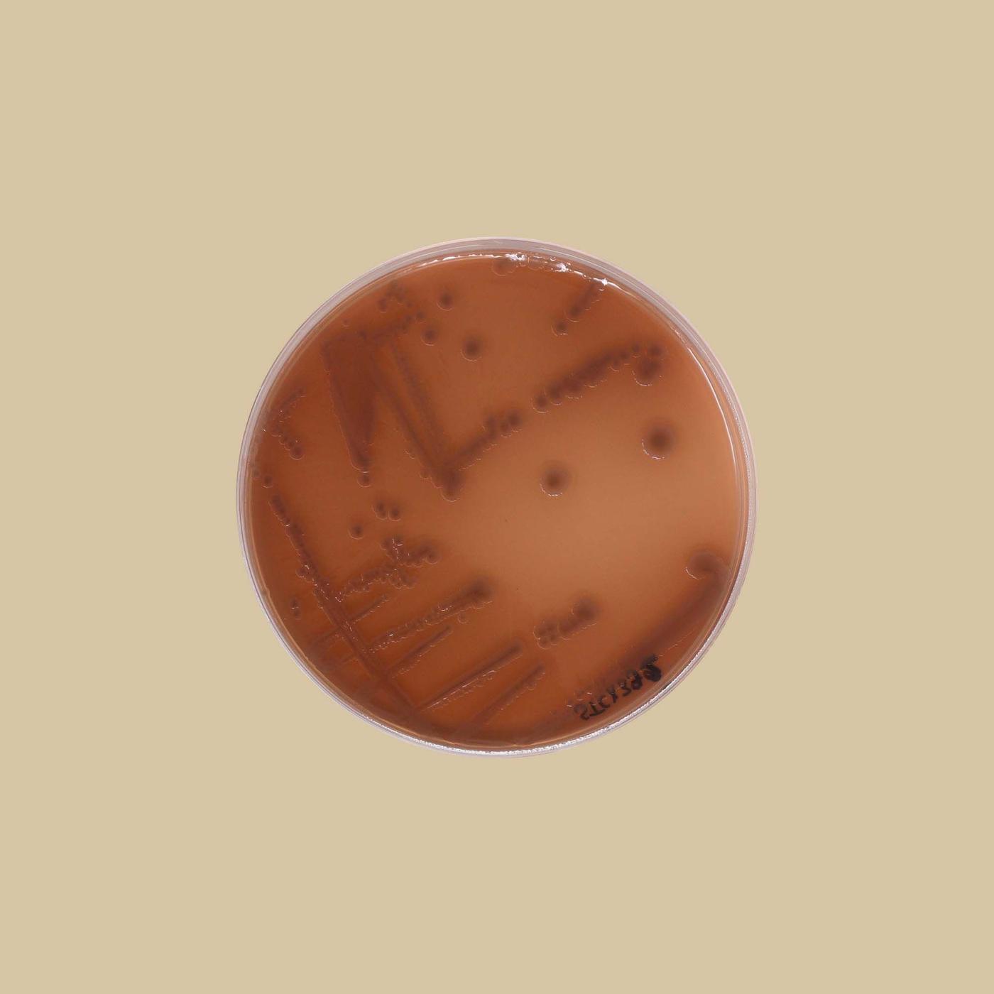 An overhead shot of a Petri dish containing mottled red bacteria.