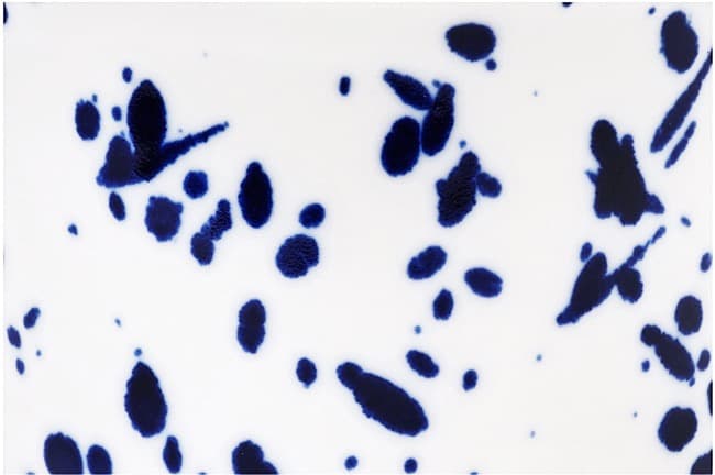 A white background with blue spattered paint pattern.