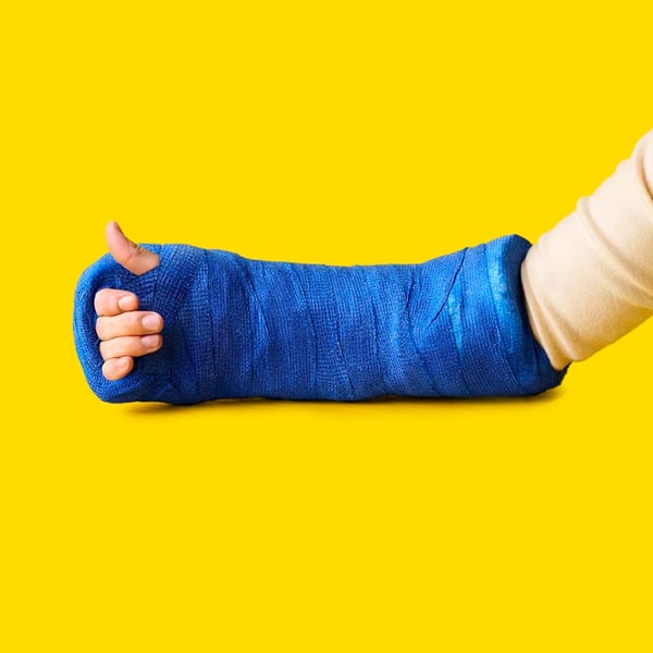 En underarm med blått gips och tummen fri, mot gul bakgrund